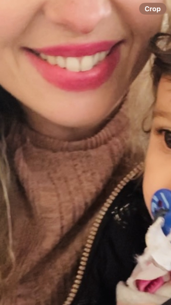 Lip filler everywhere