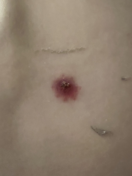 Could this be infected ?