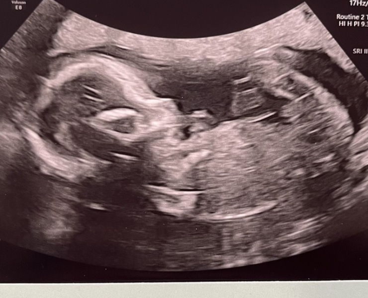 BOY OR GIRL? Any guesses?