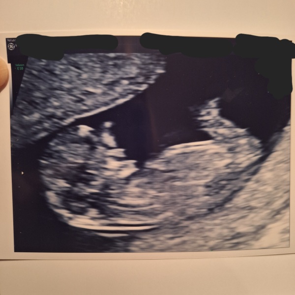 Due May 2024? Part 2