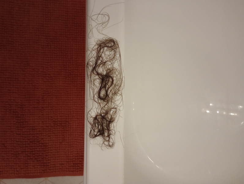 Anyone else's skin and/or hair gone to absolute shit? Warning: gross pic