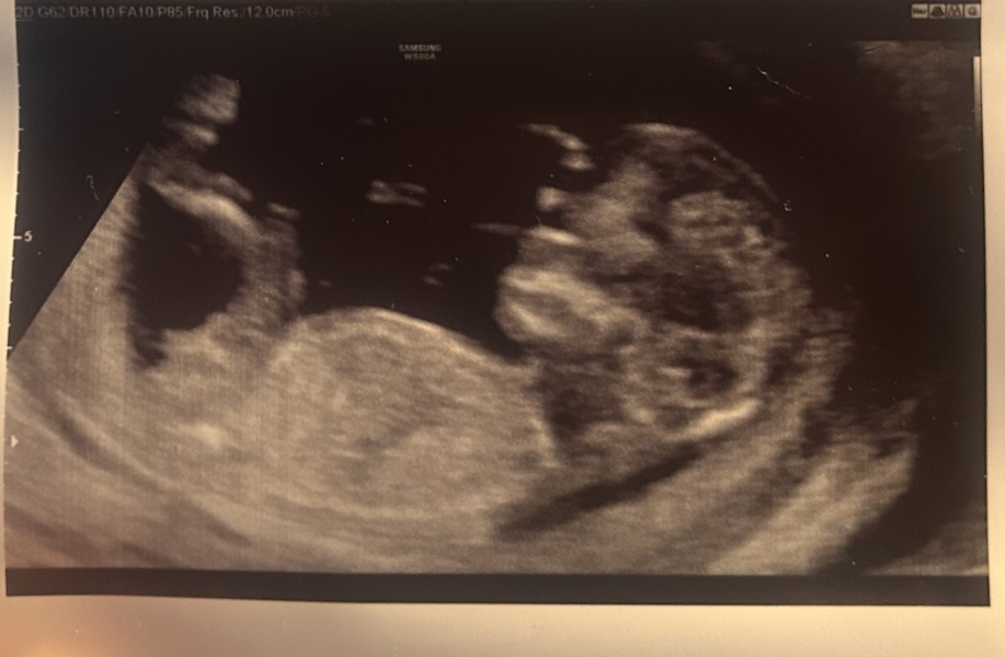 Guess the baby scan gender with me