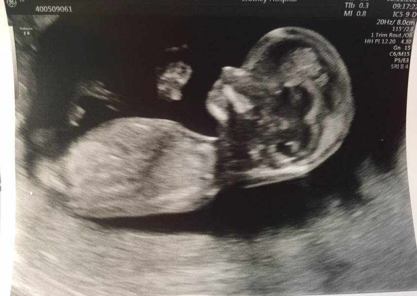 POAS come on you rainbows