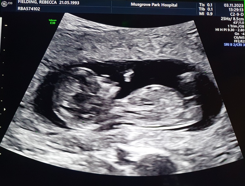 Due May 2024? Part 2