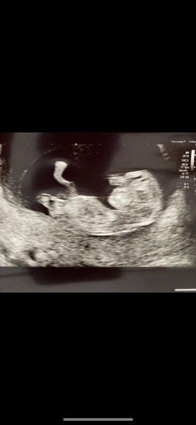 Gender Guesses!