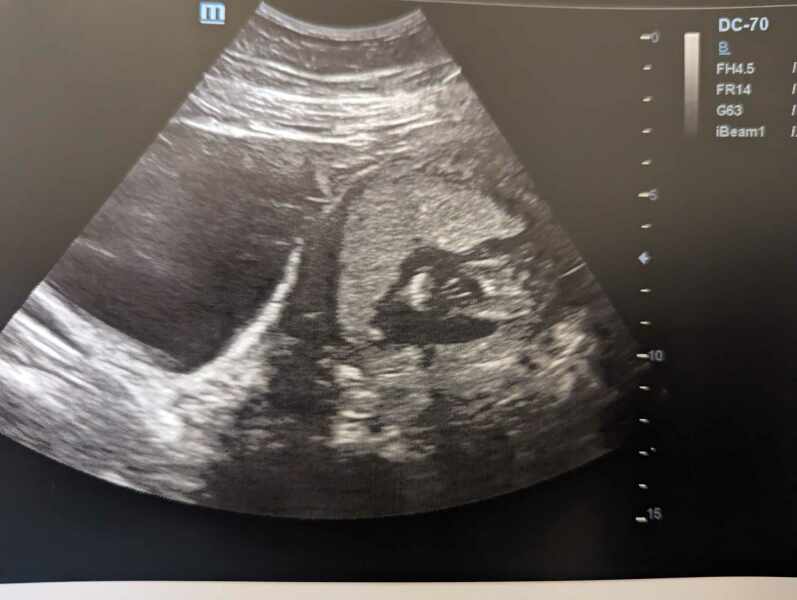 Can someone tell me what I'm looking at on this scan?