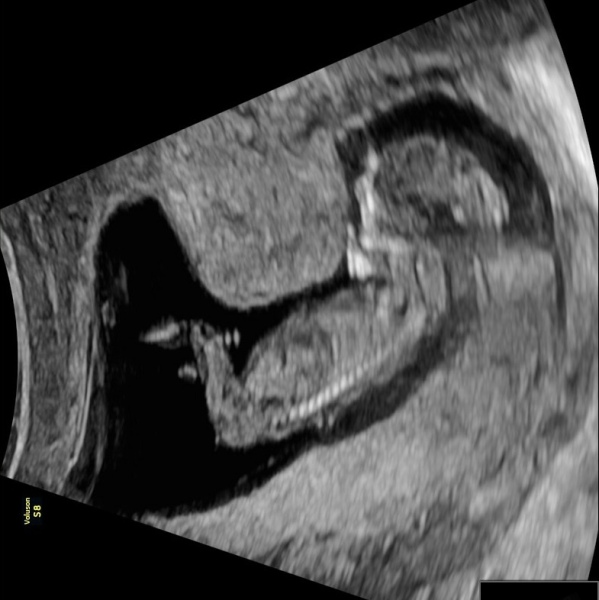 Boy or girl?