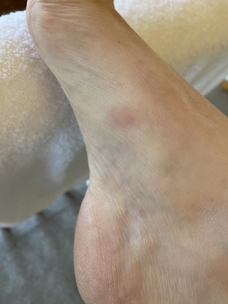 Bed bugs or something else? Pic