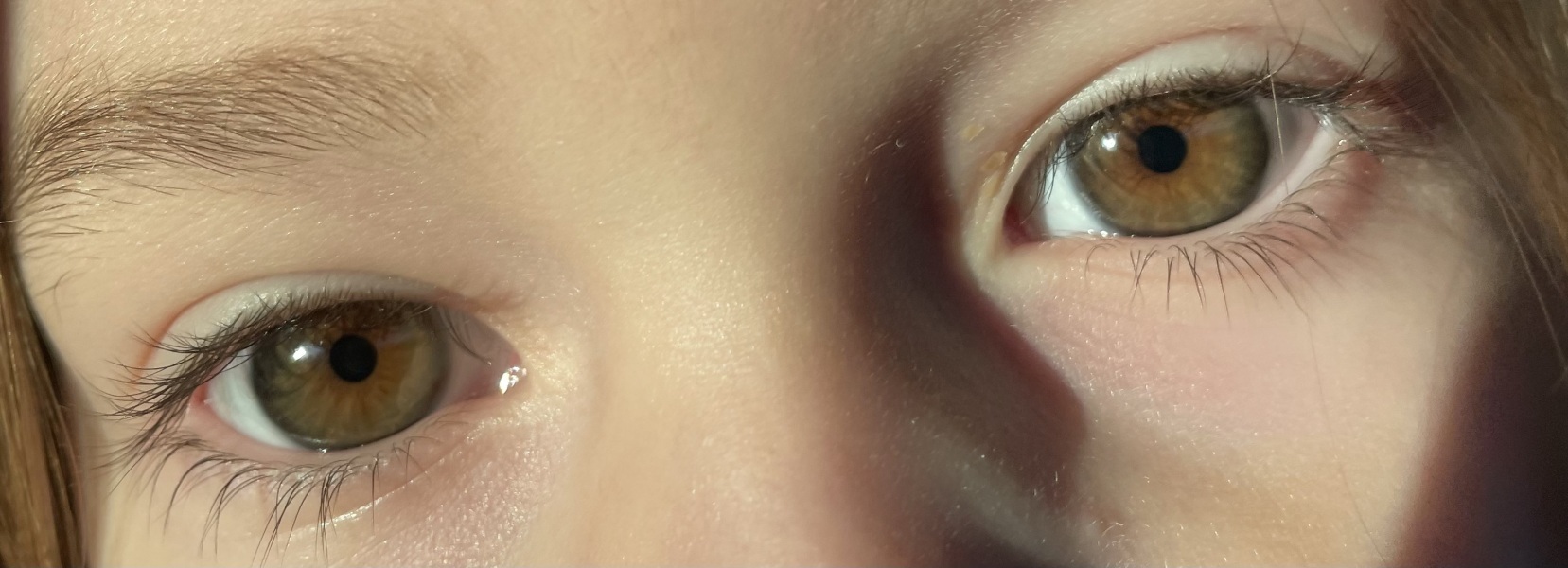 Eye colour