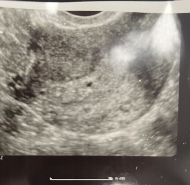 SENSITIVE- is this me losing the baby?
