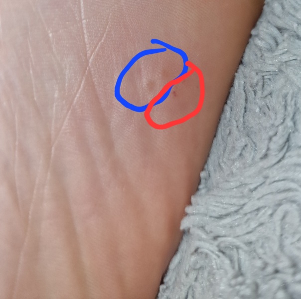 What's this on my foot?