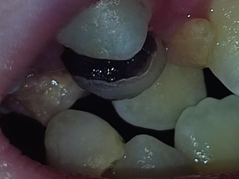 Any Dentists- is this urgent?