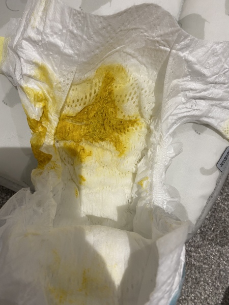 Newborn poop