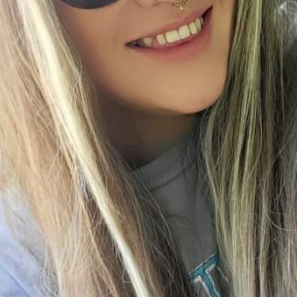 What is with lip fillers?!? They look so fake and awful