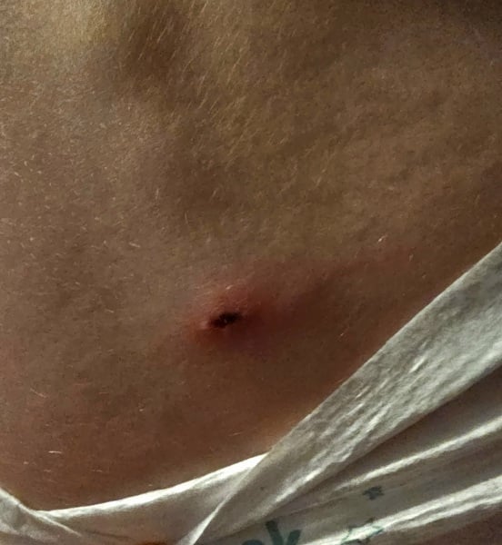 does this look infected? (pic)