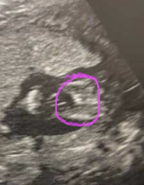 Can someone tell me what I'm looking at on this scan?