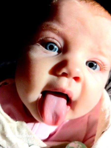 3 month old suddenly not moving legs