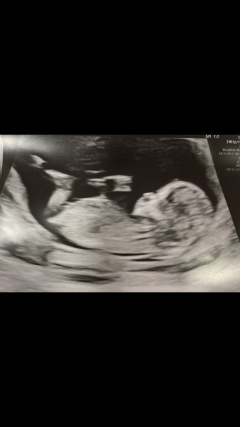 17 hours till we find out! Boy or girl!?