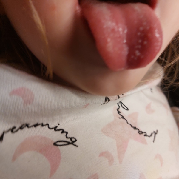 Tongue issues.