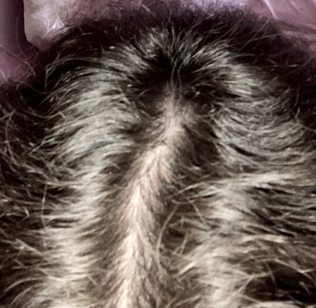 When did you start going grey? And do you dye your hair?