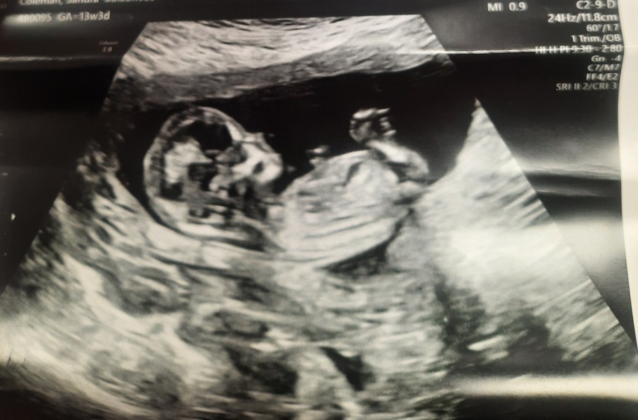 Boy or girl any ideas?