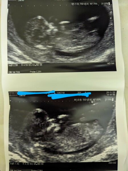 Nub guess? Girl or boy?