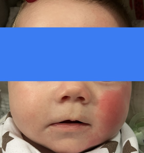 Is this teething?!