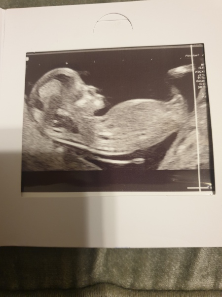 Boy or Girl?
