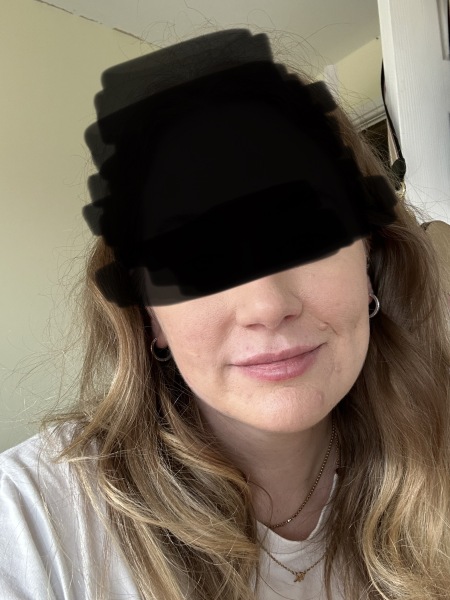 What is with lip fillers?!? They look so fake and awful