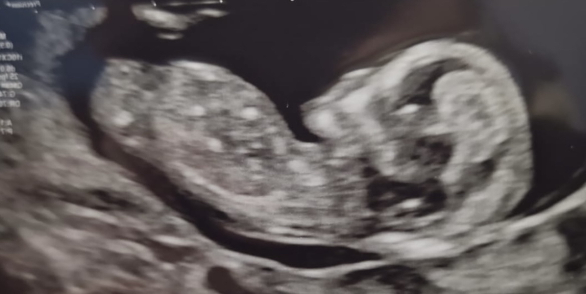 Nubologists question - any experiences?