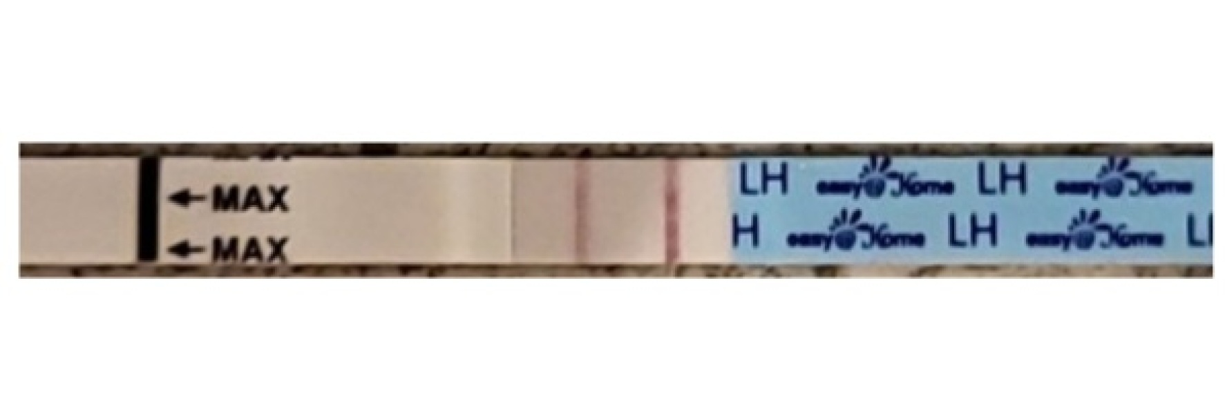 1DPO