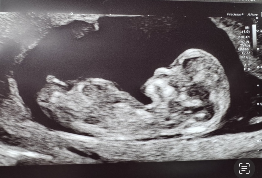 Boy or girl?