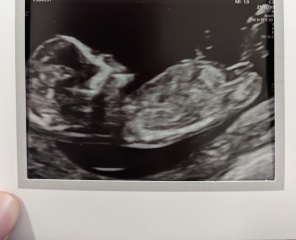 Boy or girl??