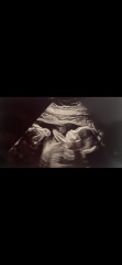 Guessing sex of baby