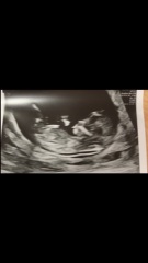 Gender reveal Saturday... final guesses...