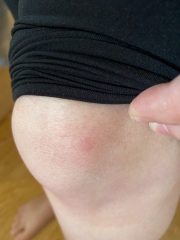 Bed bugs or something else? Pic