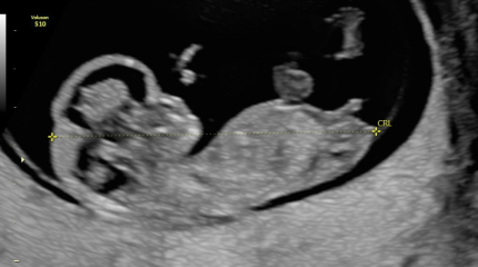 Nub theory - confused by scan