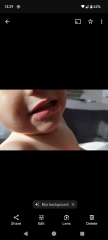 Chicken pox or hand foot and mouth?