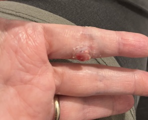 What is this lump?