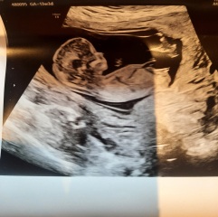 Boy or girl any ideas?