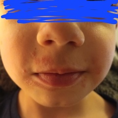 What is this on DS' face?! Photo included.