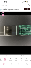 TWW - 2DPO who's with me?