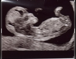 Place your random bets... nub/skull theory! 👶