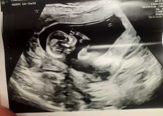Boy or girl any ideas?