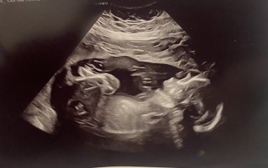Guessing sex of baby