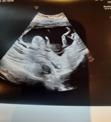 Boy or girl any ideas?