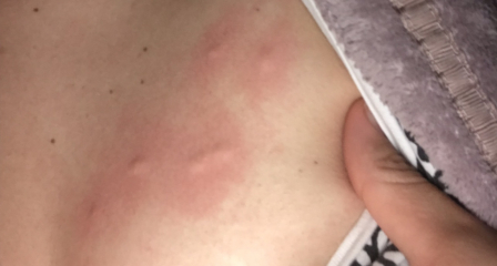 Bed bugs or something else? Pic