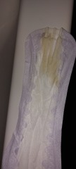 My waters or lots of discharge?