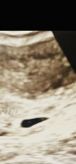 Early scan 2dots