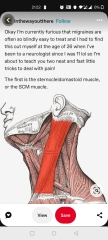 Migraines - help needed please!